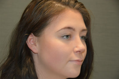 after image